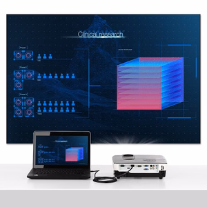 Ugreen HDMI - micro HDMI -kaapeli 19-nastainen 2.0v 4K 60Hz 30AWG 1,5 m musta (30102)